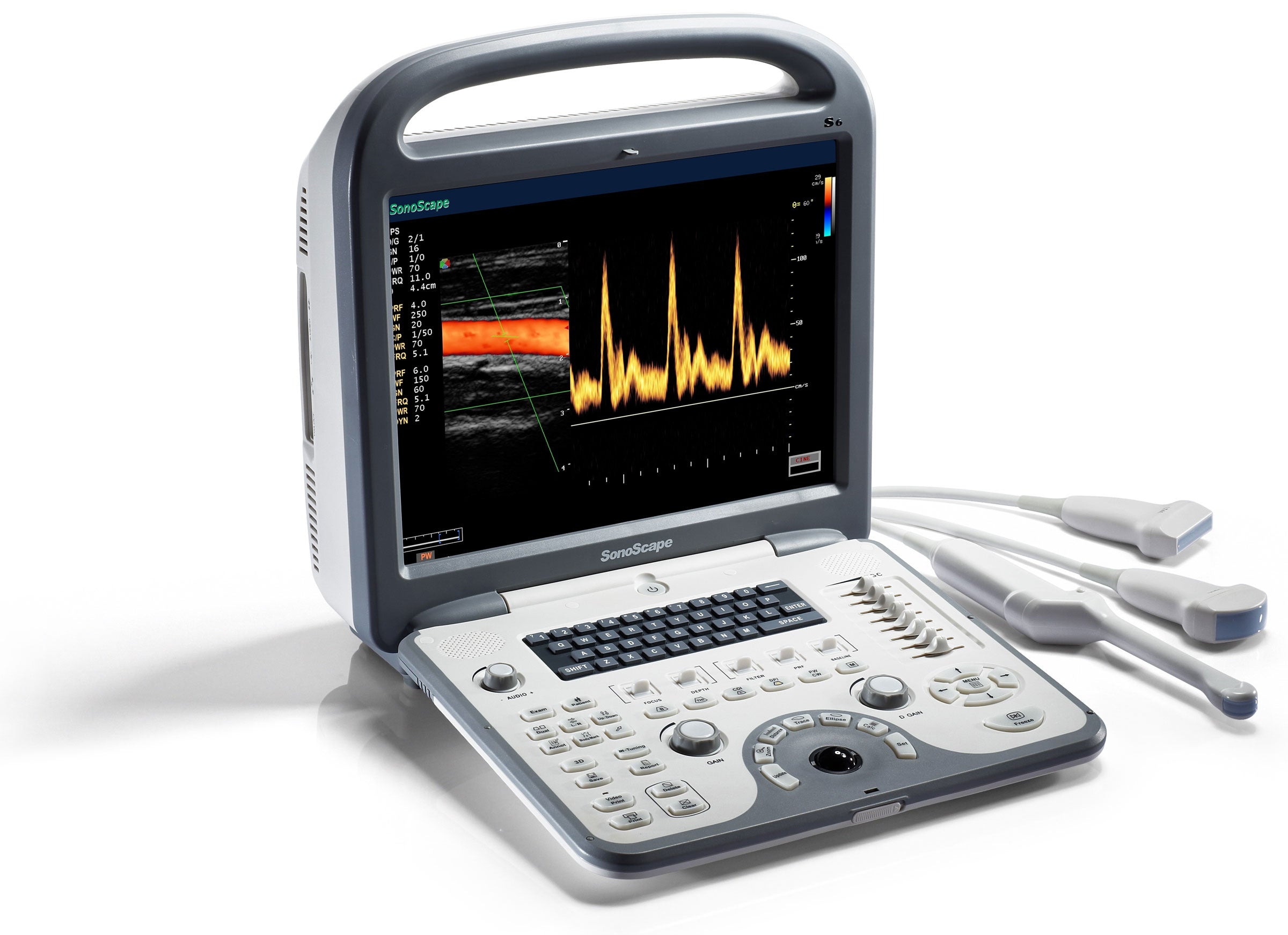 Sonoscape S6 (2 əl)